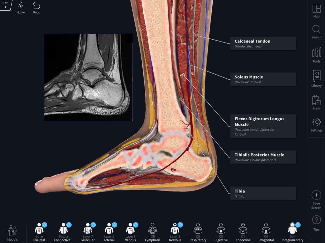 Complete Anatomy Professional 日本スリービー サイエンティフィック