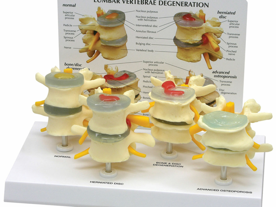 中古品 劇的ヘルニア/新品 7日間ギックリ腰克服プログラム 望永航史