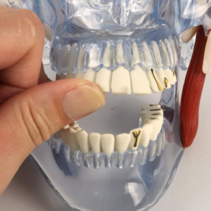 下顎の歯