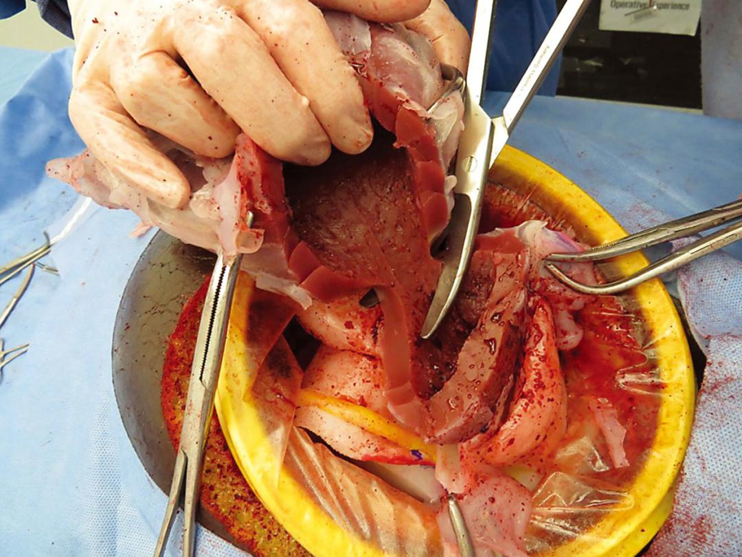 緊急子宮摘出トレーナー 日本スリービー サイエンティフィック