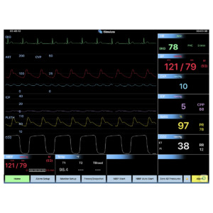 CARESCAPETM B40 Patient Monitor Simulation
