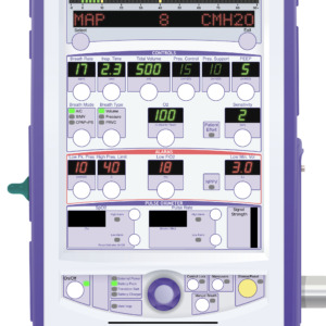 ReVel®Ventilator Screen Simulation