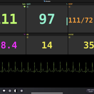 ジェネリック・スクリーン: Vital Signs with Single Waveform Simulation