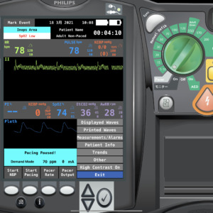 異所性と電気的ノイズが乗ったII 誘導波形（Philips HeartStart MRx Emergency Care Patient Monitor Simulation）
