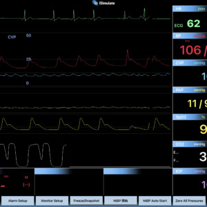 Critical Care Waveformの表示