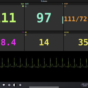 Vital Signs with Single Waveform Screen Simulation