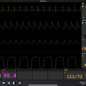 Monitor Screen Simulation