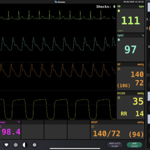 Defibrillator Screen Simulation