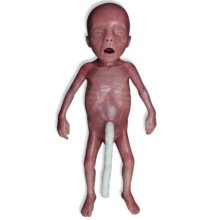 Lifecast新生児マネキン，超低出生体重児