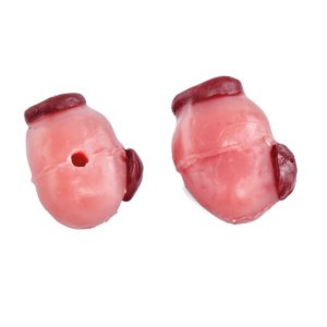 大型黄体を有する卵巣