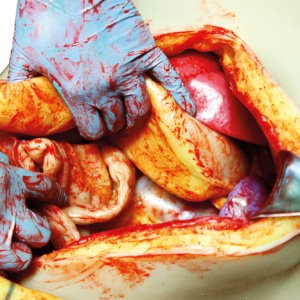 トレーニング例