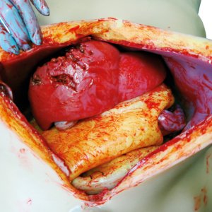 OS3（オープン・サージカル・シミュレーション・システム）