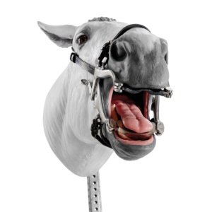 スペキュラムの装着