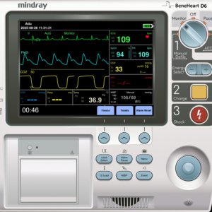 Mindray-BeneHeart-D6-MonitorDefibrillator-Screen-Simulation