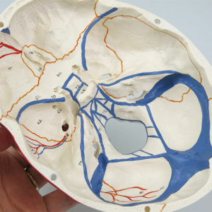内頭蓋底：静脈洞なども表現