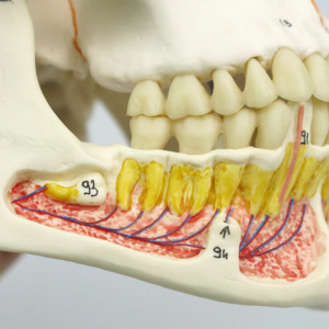 右側の下顎：血管の分布を表示