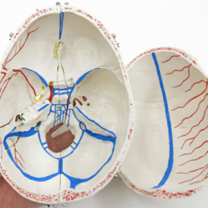 内頭蓋底：：静脈洞なども表現