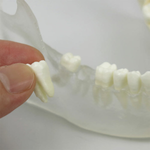 歯牙32本は個別に成型，抜歯も可能