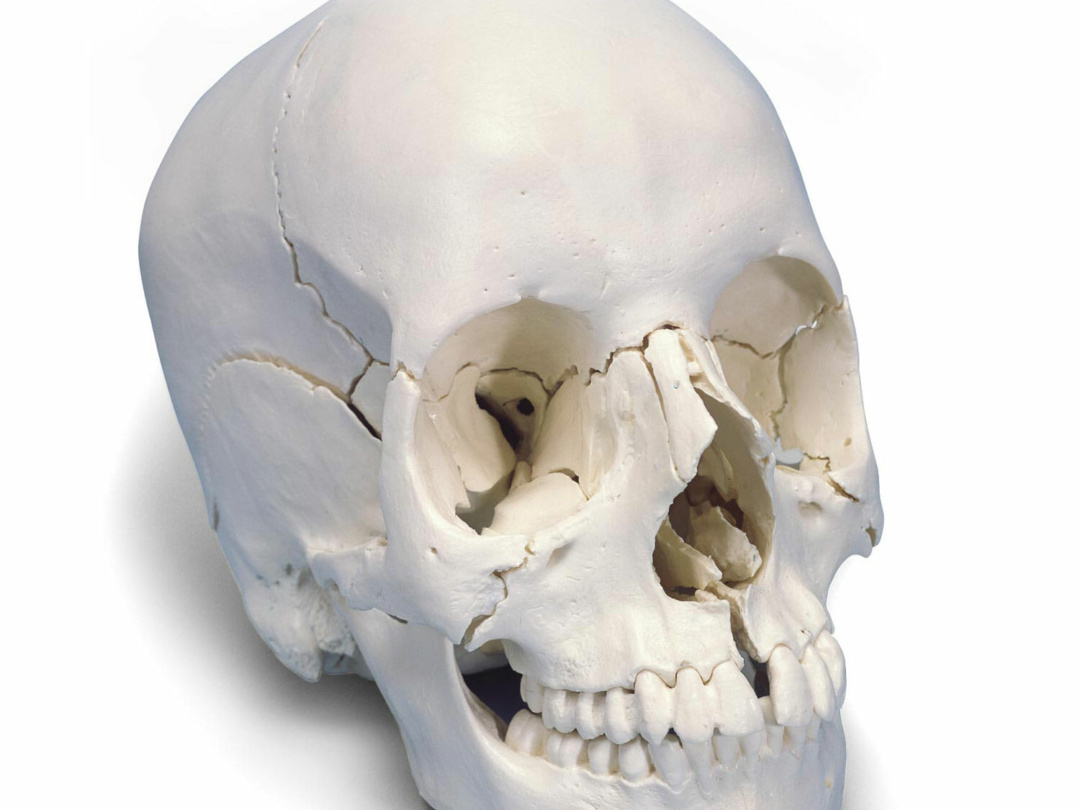 頭蓋骨22分解キット ナチュラルカラー仕様 日本スリービー サイエンティフィック