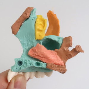 上顎洞など頭蓋骨内部の構造もわかります