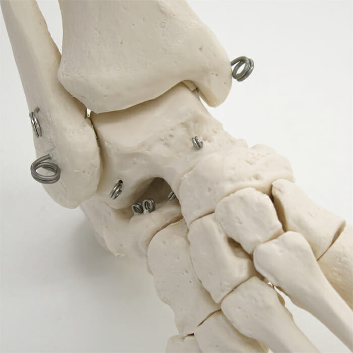 下肢骨モデル，寛骨付 - 日本スリービー・サイエンティフィック