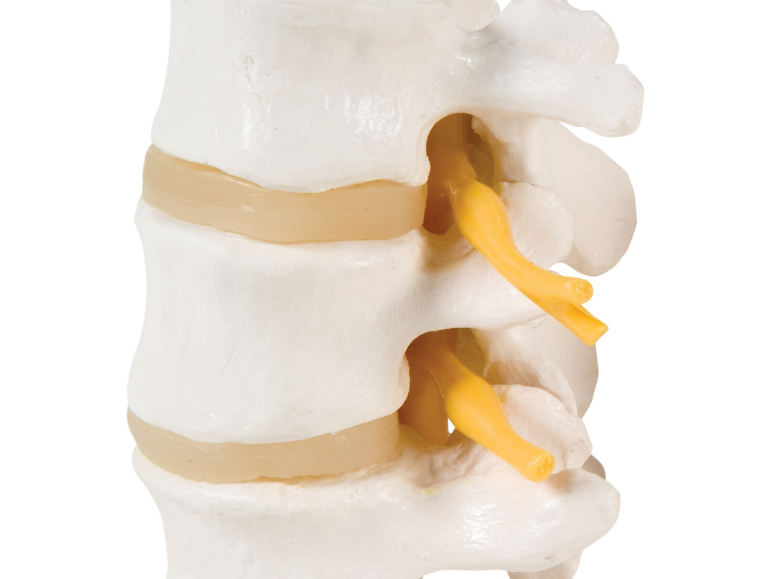 3交連腰椎モデル | 日本スリービー・サイエンティフィック