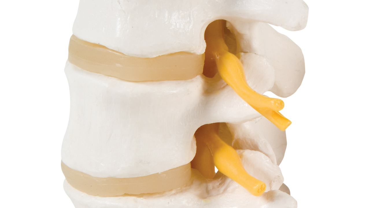 3交連腰椎モデル | 日本スリービー・サイエンティフィック