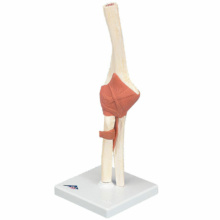 肘関節，機能デラックスモデル