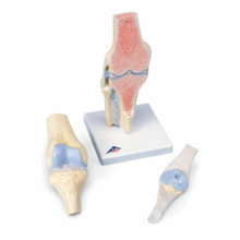 膝の関節断面，3分解モデル
