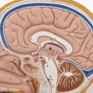 正中矢状断面：脳