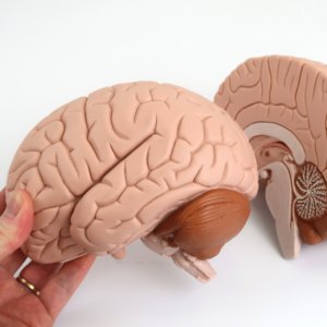 矢状断で分割できます