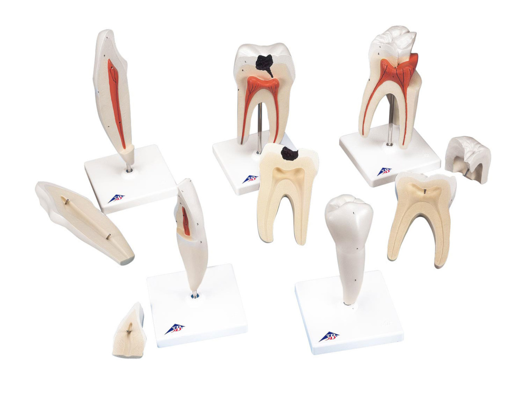 歯のシリーズ，8倍大モデルセット | 日本スリービー・サイエンティフィック