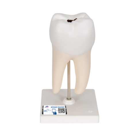 下顎大臼歯（2根）モデル