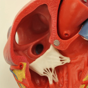 右心房内から見た冠状静脈洞開口部