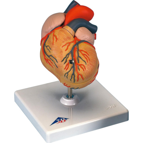 心臓，左心室肥大・2分解モデル