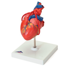 心臓，バイパス付・2分解モデル