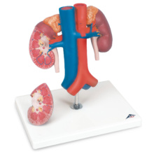 腎臓と大動脈・大静脈モデル