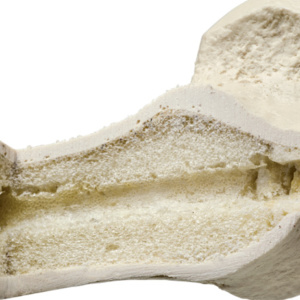 骨端ー骨幹端間の断面で硬く緻密な皮質骨，柔らかい海綿骨，髄腔を確認できます。
