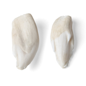 歯の標本例5