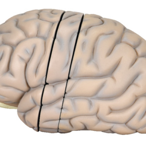 左脳：側面