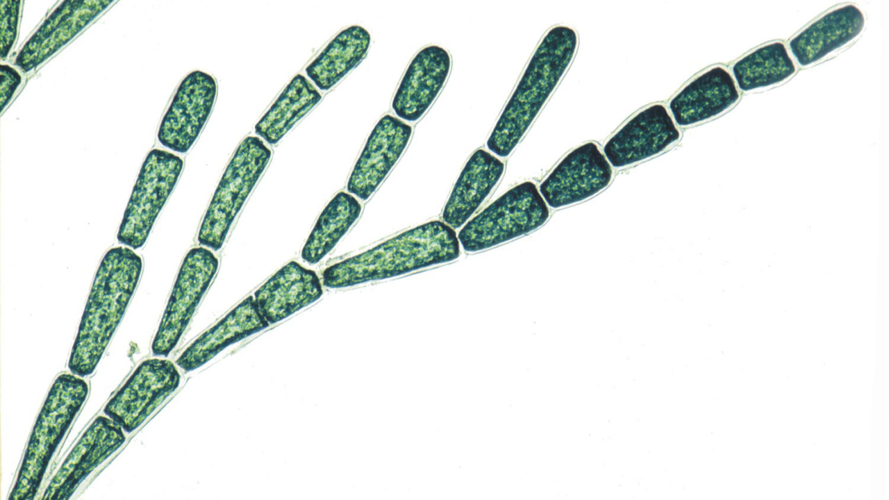 Amazon.com: The Freshwater Algal Flora of the British Isles