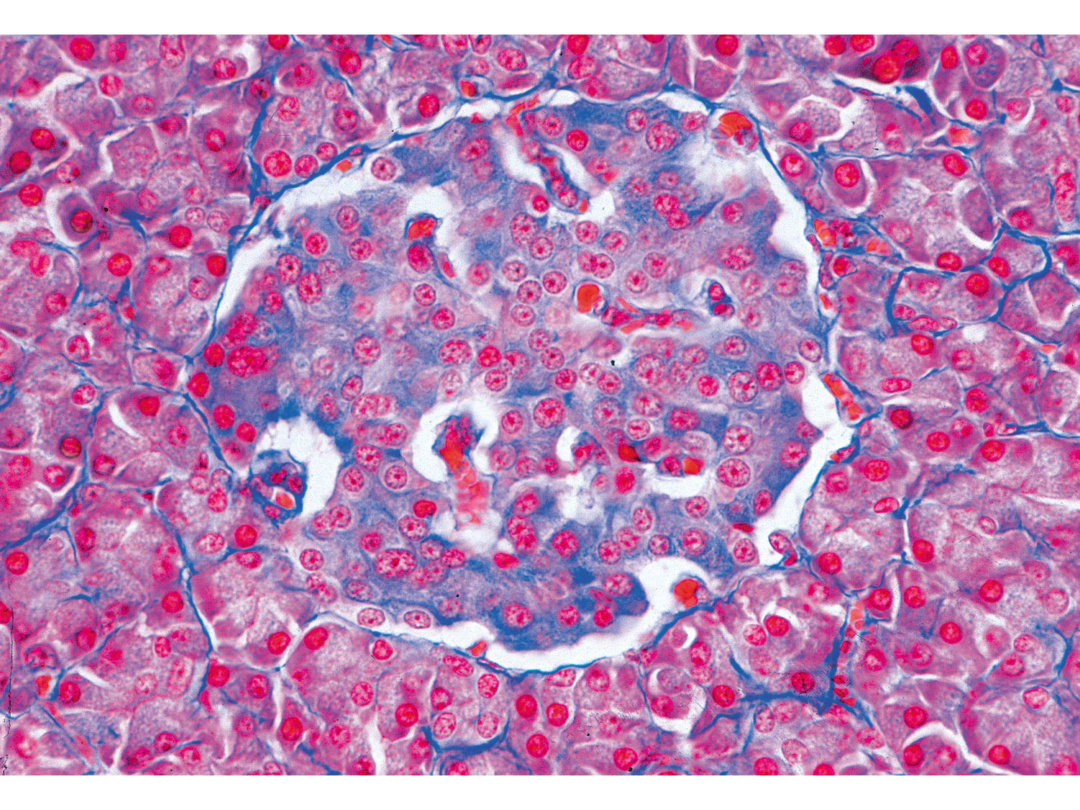 循環器セット＆ホルモン表 病気がみえるセットvol.1~11（5欠品）10冊セット循環器