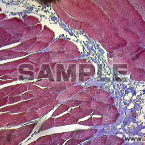 肉胞子虫・ミーシェル管内の寄生虫を示す筋の断面