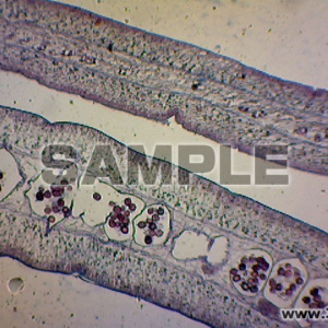 条虫・タエニア属・様々な発生段階の片節（横断）