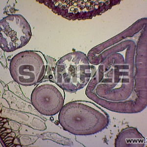 ヒトの回虫・雌の成虫の生殖巣（横断）