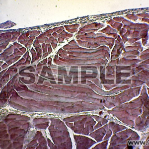 肉胞子虫・ミーシェル管内の寄生虫を示す筋の断面