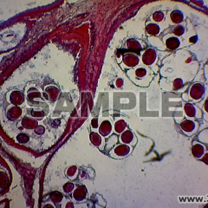 単胞条虫，胞嚢壁と頭節