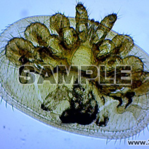 アカリンダニ・ミツバチの気管ダニ（全体像）