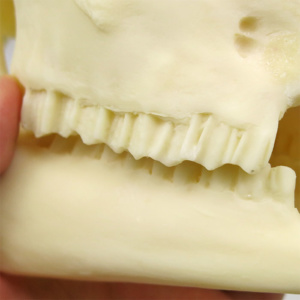 前臼歯