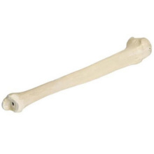 ORTHObones 脛骨